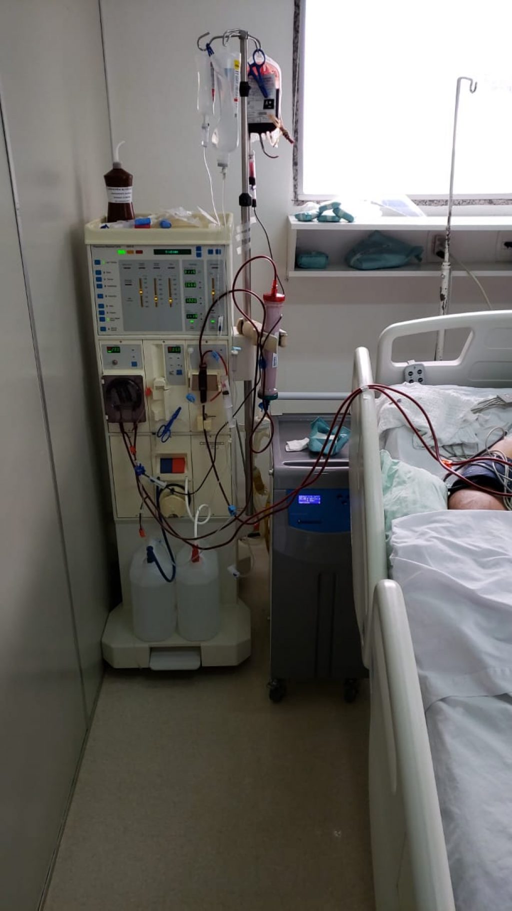 Hospital Frei Clemente recebe aparelho Osmose